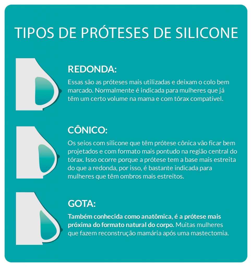 Tipos de prótese de silicone Mamoplastia de aumento: existe tamanho ideal?